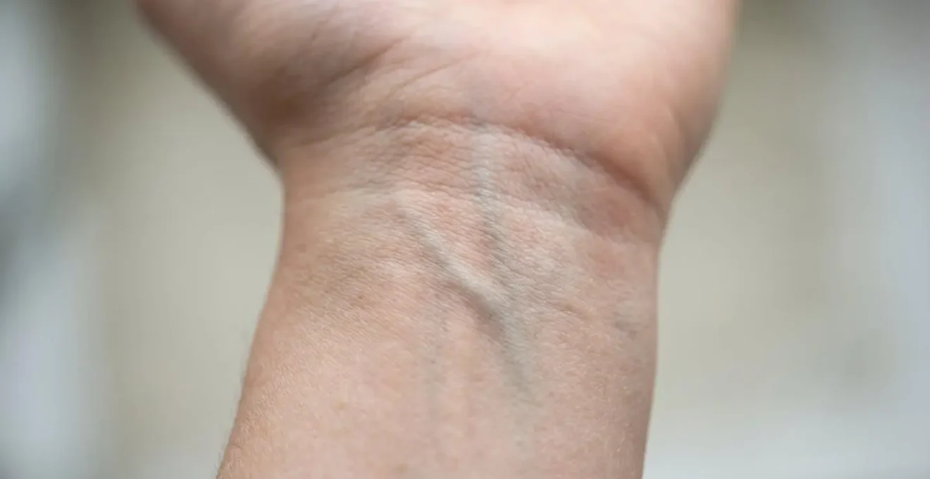 Nahaufnahme Handgelenk mit sichtbaren Venen zur Hautunterton-Bestimmung